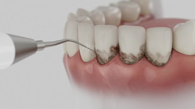 Trusted Tooth Extraction service in Fairmount, IN - Dentist Open Now